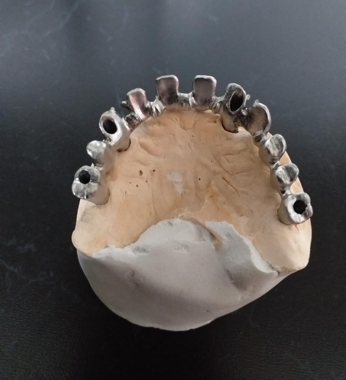 Base sobre Implantes